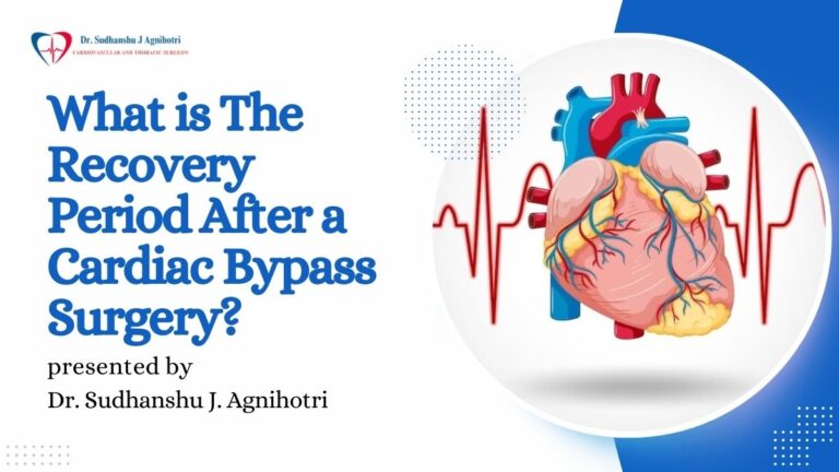 What is The Recovery Period After a Cardiac Bypass Surgery?