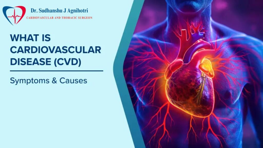 Cardiovascular Disease by Dr Sudhanshu J Agnihotri - Best Heart Specialist In Indore