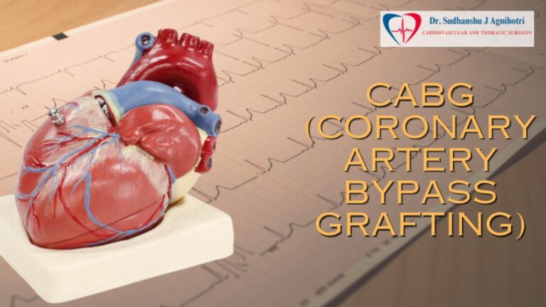 कोरोनरी आर्टरी बायपास ग्राफ्टिंग (Heart Specialist near Me) क्या है: Dr Sudhanshu J Agnihotri