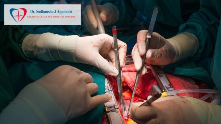 Heart Bypass Surgery by Dr. Sudhanshu J. Agnihotri, Best Cardiac Surgeon in Indore