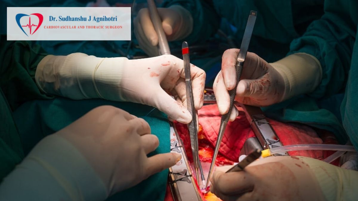 Heart-Bypass-Surgery by Dr Sudhanshu J Agnihotri - Best cardiac Surgeon In Indore