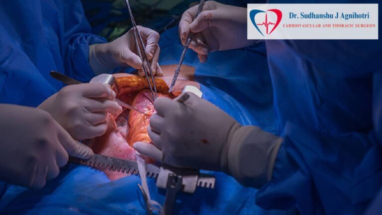 What You Need to Know About Heart Transplant