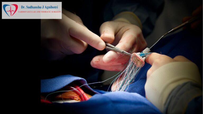 What Is Re-operative Heart Surgery(Cardiac Specialist near Me) and When Is It Needed Again?