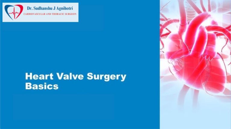 Heart Valve Surgery: Could the Best Cardiac Surgeon in Indore Save Your Heart Today?