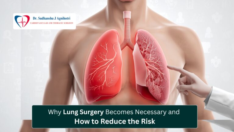 Why Lung Surgery Becomes Necessary and How to Reduce the Risk
