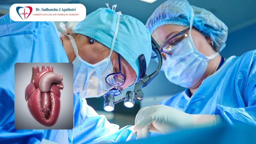 क्या बेंटल सर्जरी ही ओपन हार्ट सर्जरी है? Cardiac Surgeon Dr. Sudhanshu Agnhihotri