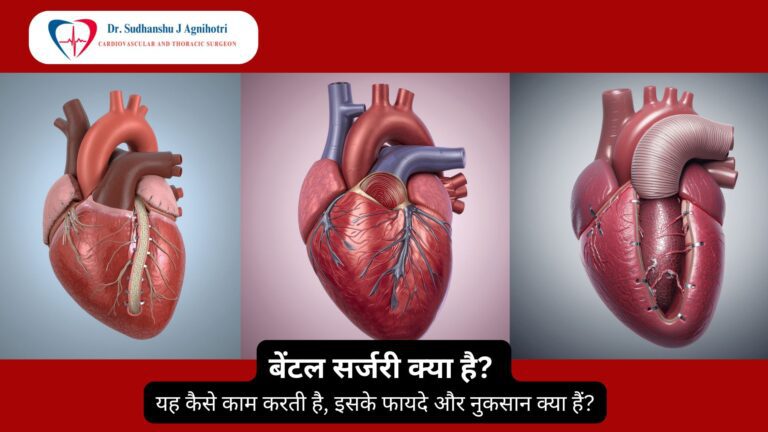 बेंटल सर्जरी से जुड़ी सम्पूर्ण जानकारी।