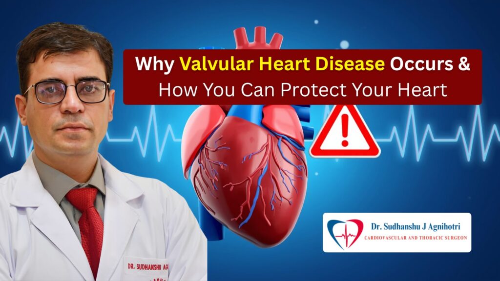 Understanding Valvular Heart Disease From Symptoms to Solutions - Dr. Shudhanshu J Agnihotri
