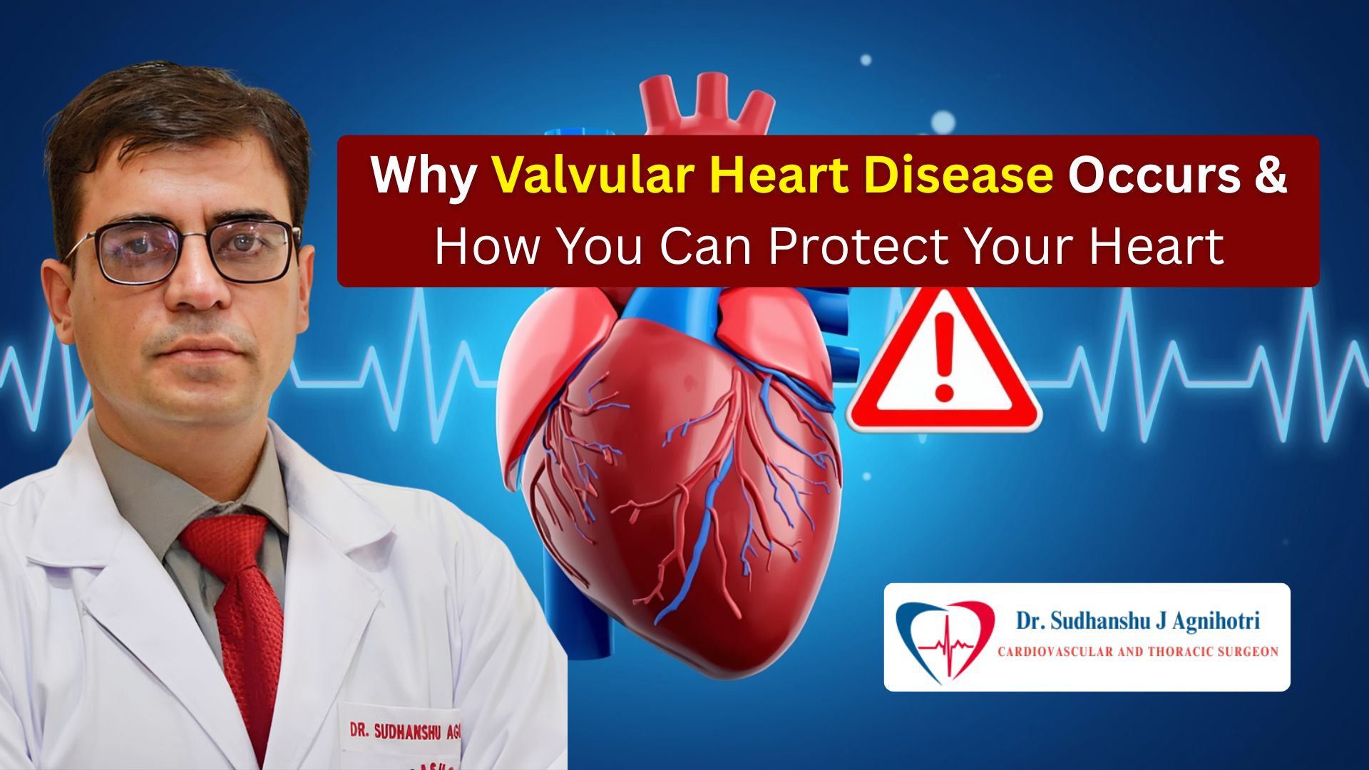 Understanding Valvular Heart Disease From Symptoms to Solutions - Dr. Shudhanshu J Agnihotri