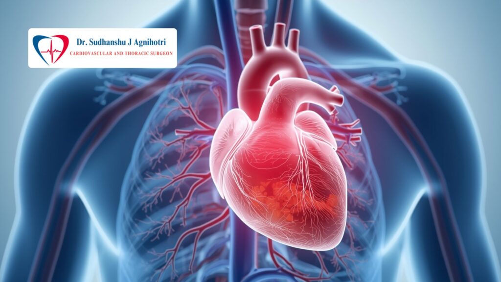 Why is heart disease increasing among diabetes patients in India - Why Diabetes Patients Facing Heart Problems