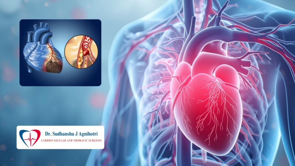 How does diabetes cause blockage in heart vessels - Why Diabetes Patients Facing Heart Problems