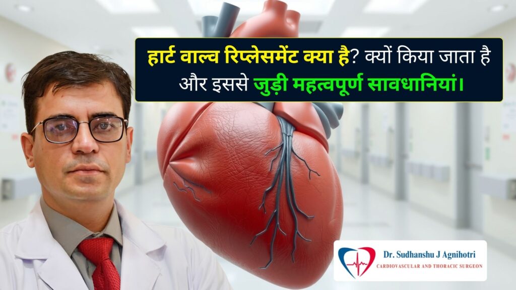 हार्ट वाल्व रिप्लेसमेंट सर्जरी प्रक्रिया, कारण, उम्र और ज़रूरी सावधानियाँ - Cardiac Surgeon Dr. Sudhanshu J Agnihotri