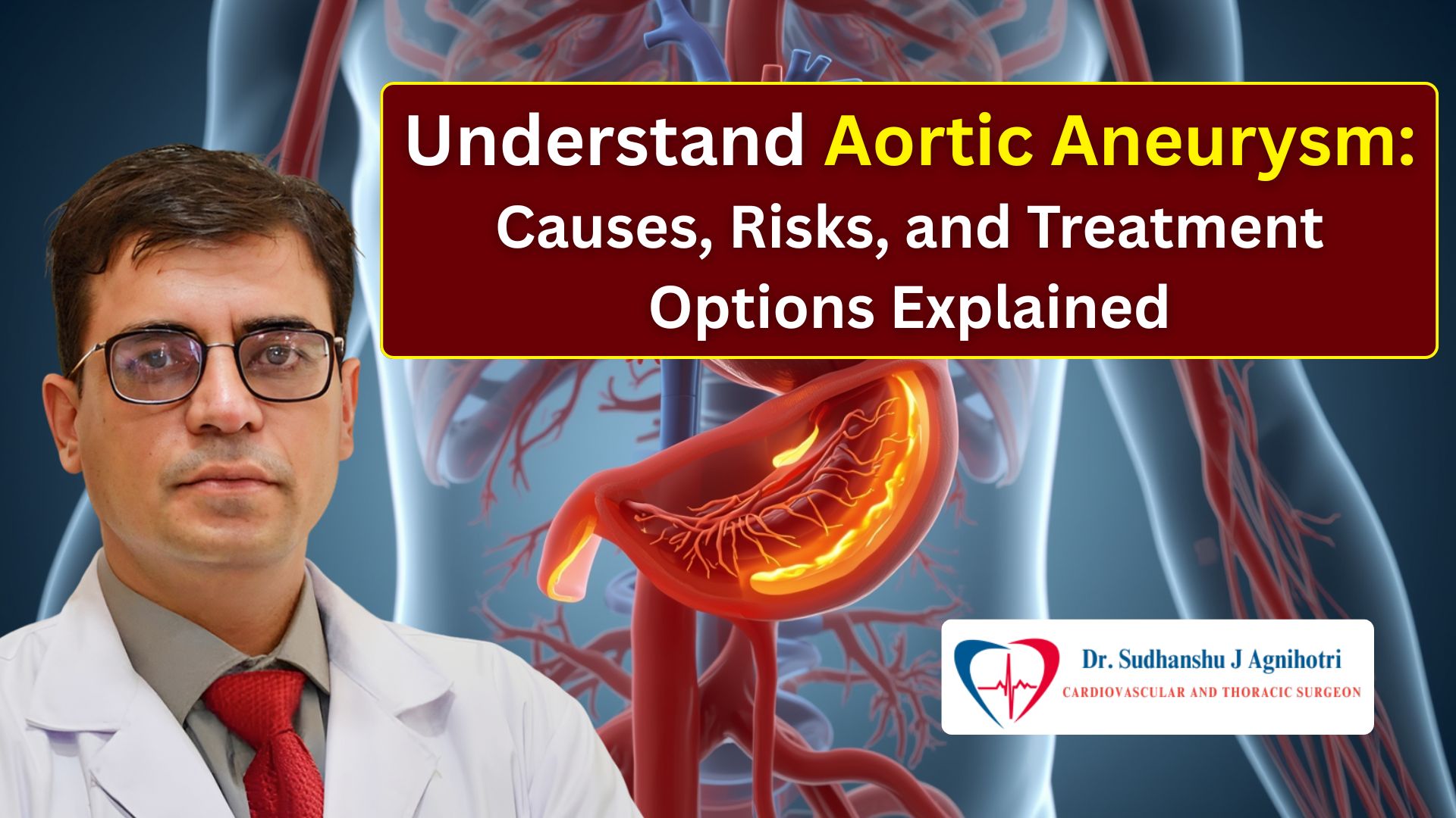 Understand Aortic Aneurysm Disease Know Its Causes, Risks, and Treatment Options - Cardiac Surgeon Dr. Sudhanshu J Agnihotri