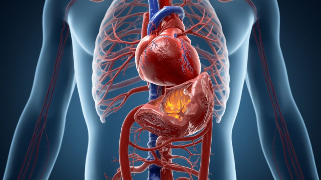 What Is Aortic Aneurysm Disease - Cardiac Surgeon Dr. Sudhanshu J Agnihotri