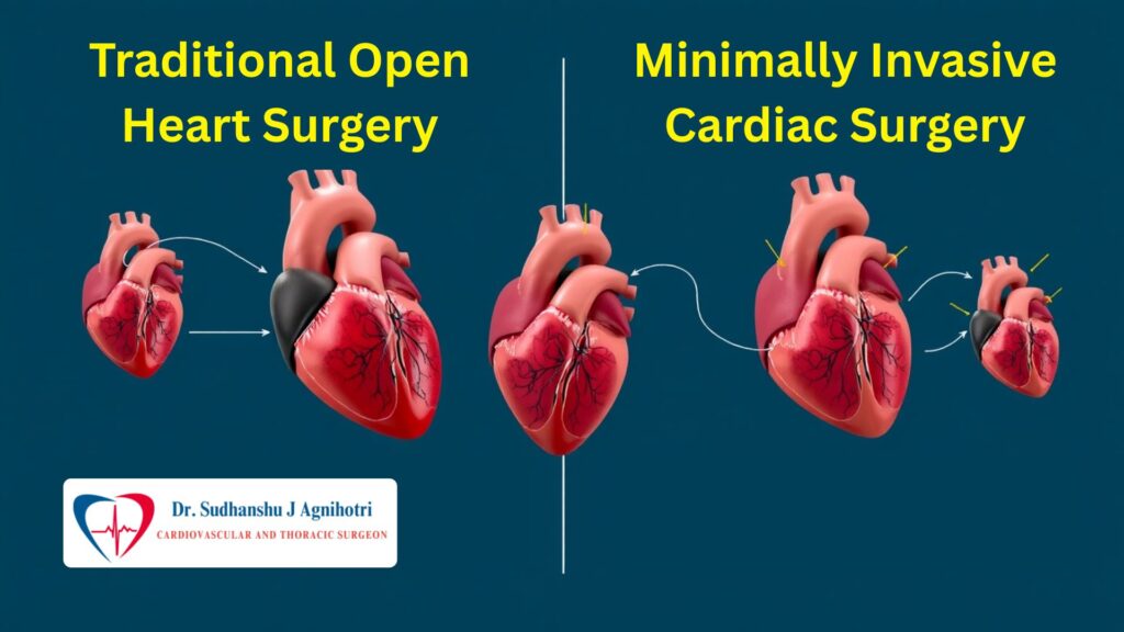 मिनिमली इनवेसिव कार्डियक सर्जरी के प्रमुख फायदे