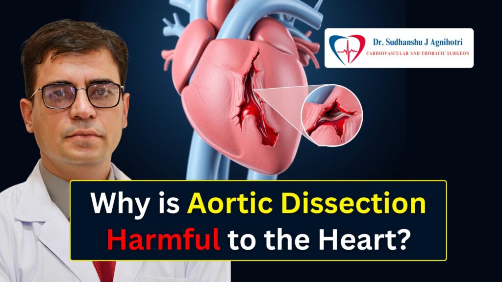 What Causes Aortic Dissection Signs, Blood Pressure Differences & Prevention Tips