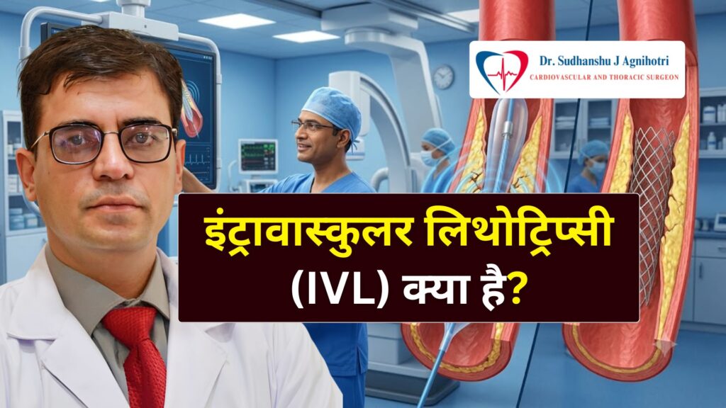 Intravascular Lithotripsy (IVL) क्या है - Cardiac Surgeon Dr. Sudhanshu J Agnihotri