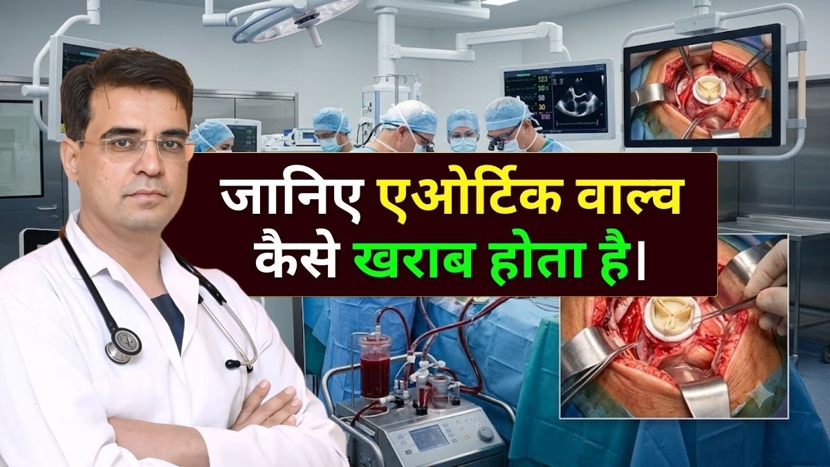 जानिए Aortic Valve कैसे खराब होता है।